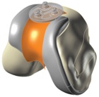 iDuo® G2 Bicompartmental Knee Resurfacing Device